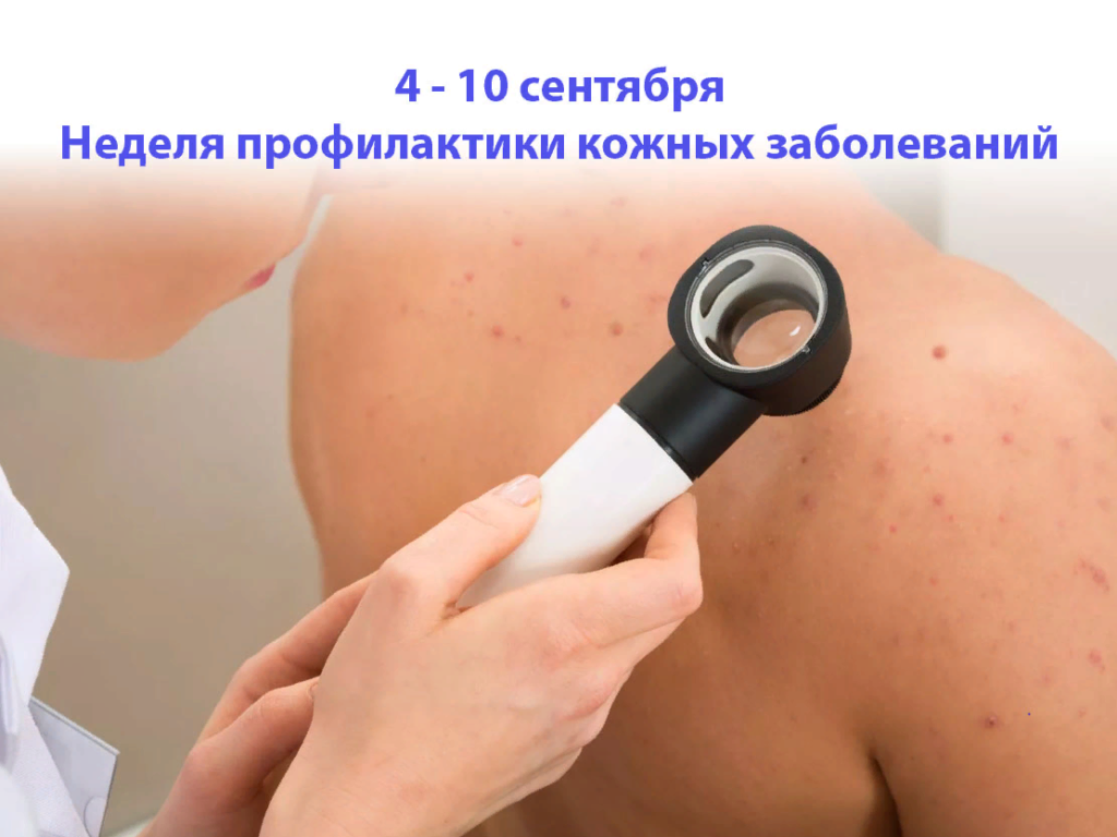 Смоленская область присоединилась к Неделе профилактики кожных заболеваний